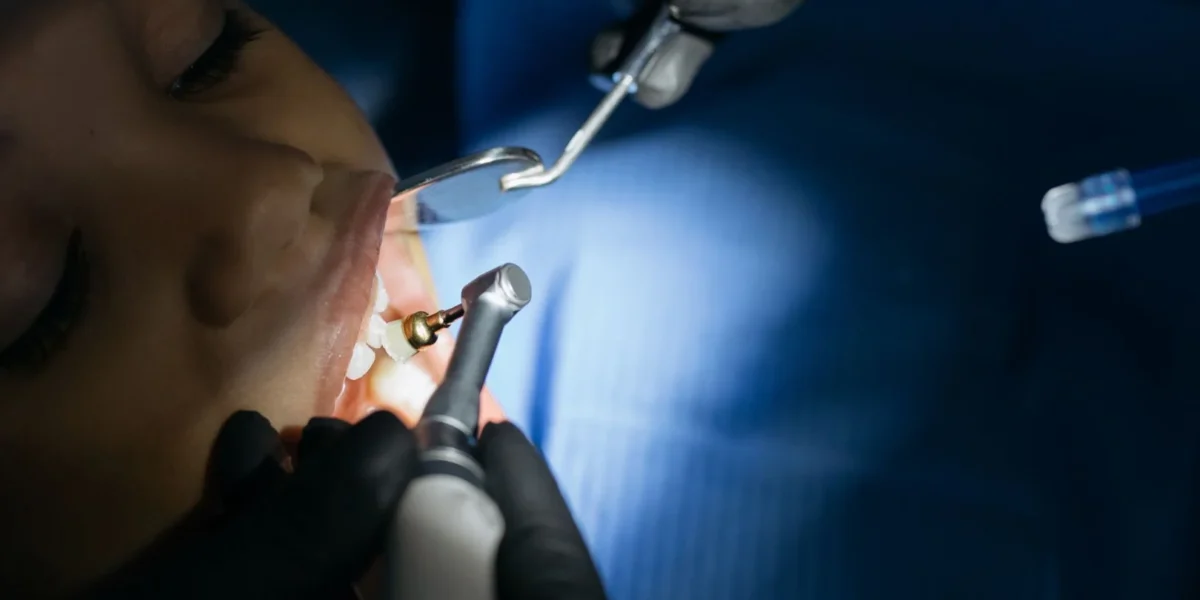 Close-up of a child receiving a dental checkup in a modern clinic with professional tools.